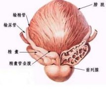 急性前列腺炎