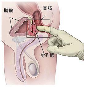 欽州桂大醫(yī)院治療前列腺炎好不好